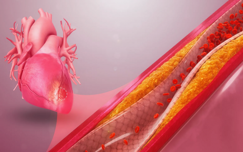Давление и одышка: Врач Лахмай перечислил 7 частых симптомов ишемической болезни сердца — проверьте себя