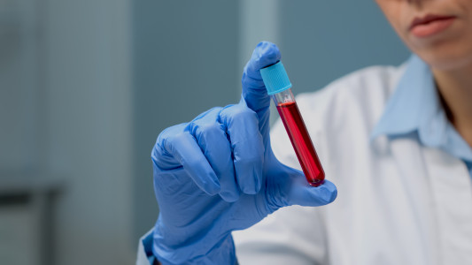 Спасение от анемии: Эксперт Роспотребнадзора Буханцев назвал продукт для нормализации уровня железа — можно вырастить на грядке