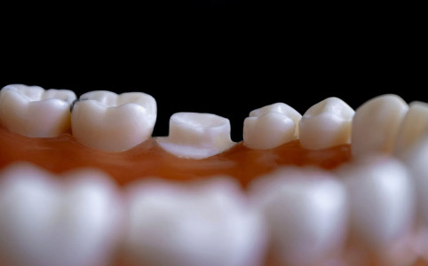 Импланты уйдут в прошлое: японские ученые хотят научиться выращивать новые зубы — опыты на людях начнутся уже в этом году