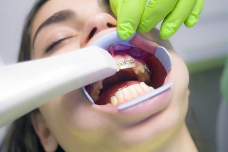 Врачи раскрыли неожиданные последствия проблем с зубами — страдает даже сердце