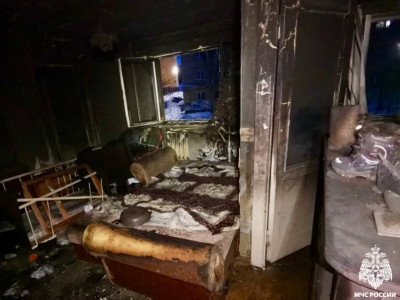 При пожаре в квартире в Мурманске пострадал ребенок