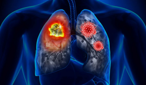 Как некурящие гробят свои лёгкие: 4 привычки, от которых орган сжимается и деградирует — пульмонолог Пешкова