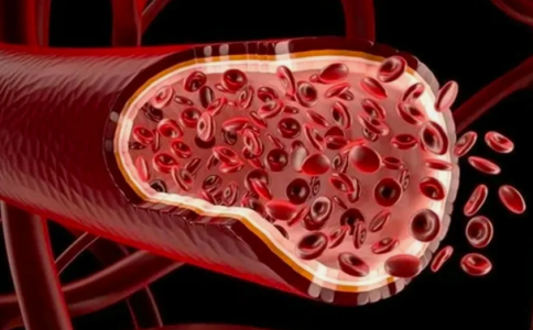 Сосуды станут шёлковые: атеросклероз больше не страшен — учёные нашли решение, испытания прошли успешно