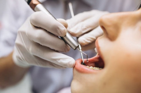Стоматолог Быстрова ответила на вопрос, можно ли получить кариес по наследству — что на самом деле сильно влияет на здоровье зубов