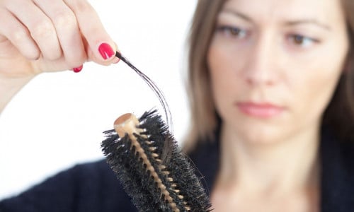 Вот почему выпадают волосы: эксперт Мкртчян назвал главные причины и рассказал, что делать, чтобы не облысеть в два счета