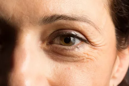 Дряблая кожа и круги под глазами: когда нужно ложиться спать, чтобы не было морщин — совет дала врач-дерматолог Андрян