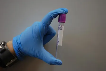 Ученые из Сингапура разработали метод диагностики рака с помощью ИИ: заболевание можно будет выявить даже на ранней стадии